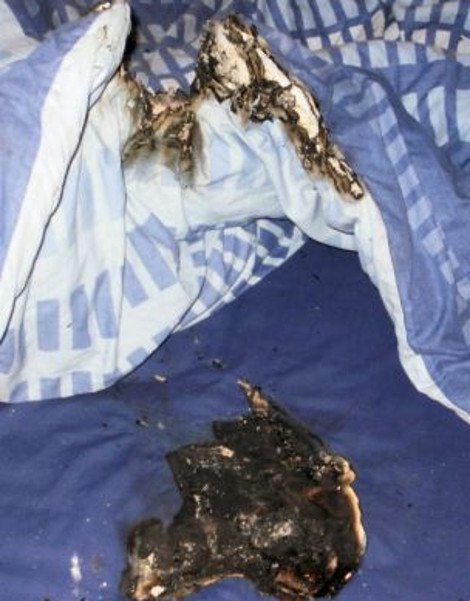 Στο νοσοκομείο 11χρονος με εγκαύματα μετά από έκρηξη BlackBerry κινητού [εικόνες] | iefimerida.gr 1