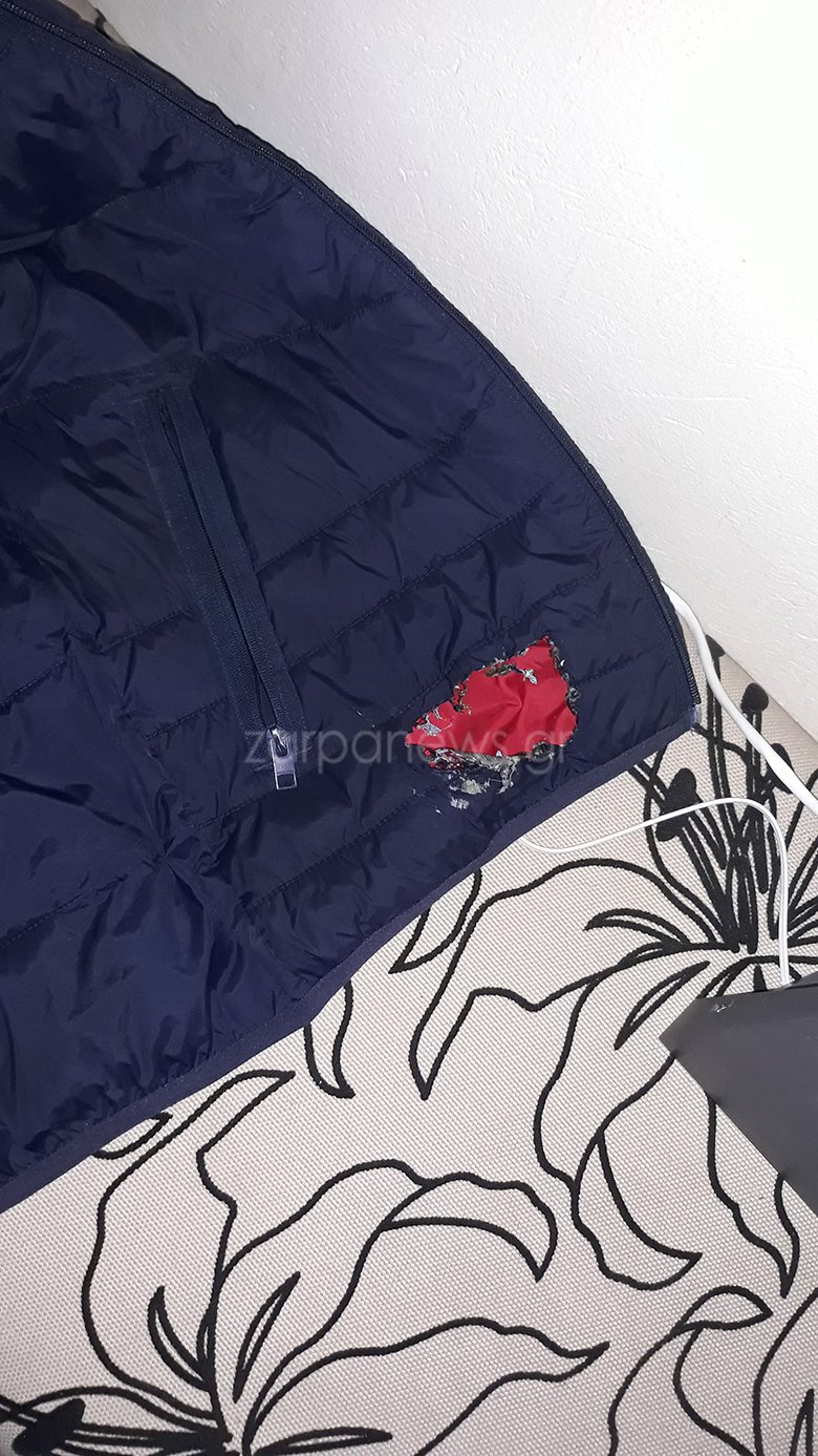 Κινητό εξερράγη στην τσέπη μαθητή στην Κρήτη [εικόνες] | iefimerida.gr 0