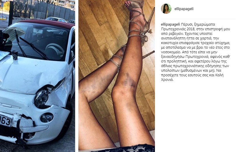 Η Ελλη Παπαγγελή δημοσίευσε εικόνα-σοκ από το τροχαίο που είχε -Γεμάτη μελανιές [εικόνες] | iefimerida.gr 0