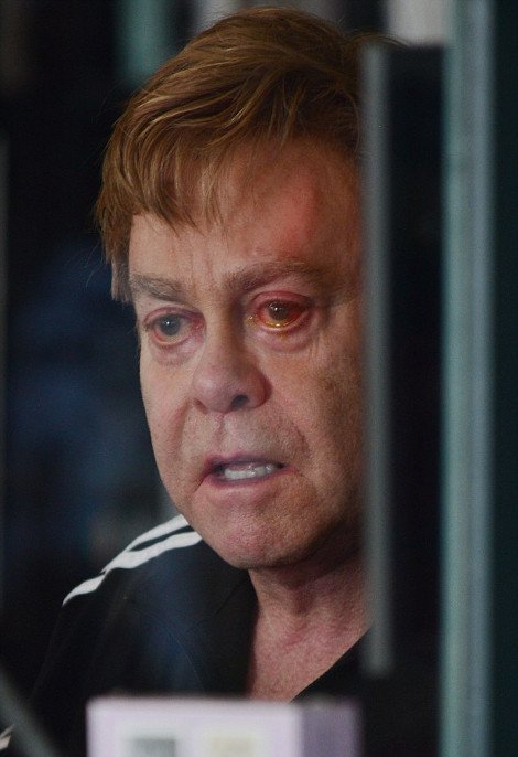 Γέρασε ο Ελτον Τζον -Σε κακή φόρμα, με παραπανίσια κιλά και πρησμένα μάτια [εικόνες] | iefimerida.gr 1