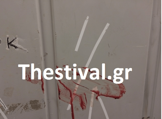 Αιματηρή συμπλοκή στο Πανεπιστήμιο Μακεδονίας με δυο τραυματίες -Κουκουλοφόροι τα έκαναν γυαλιά καρφιά [εικόνες] | iefimerida.gr 1