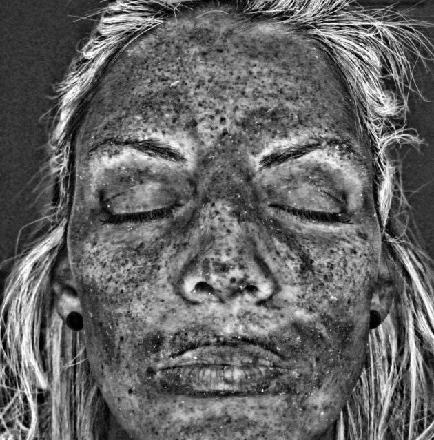 Σοκαριστική φωτογραφία δείχνει τη ζημιά που προκαλεί το σολάριουμ στο δέρμα [εικόνα] | iefimerida.gr 1