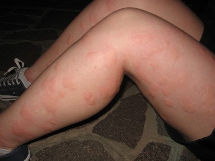 Γιατί το καλοκαίρι είναι η εποχή των εκπλήξεων [εικόνες] | iefimerida.gr 2