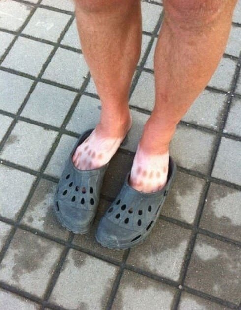 Γιατί το καλοκαίρι είναι η εποχή των εκπλήξεων [εικόνες] | iefimerida.gr 6