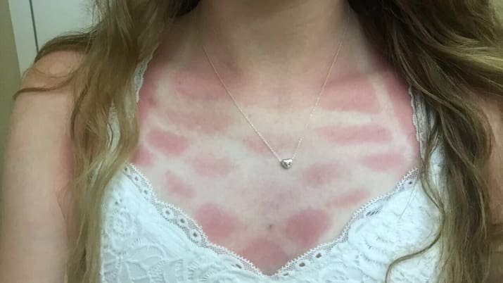 Γιατί το καλοκαίρι είναι η εποχή των εκπλήξεων [εικόνες] | iefimerida.gr 7