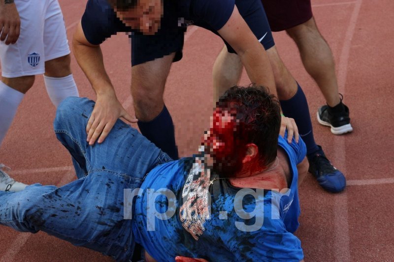 Αγρια επεισόδια σε αγώνα της Γ' Εθνικής μεταξύ οπαδών και ΜΑΤ [εικόνες & βίντεο] | iefimerida.gr 0