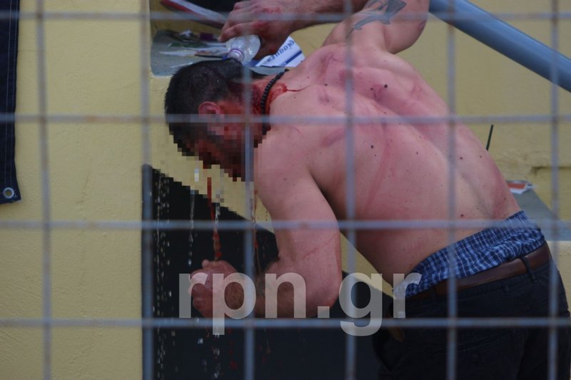 Αγρια επεισόδια σε αγώνα της Γ' Εθνικής μεταξύ οπαδών και ΜΑΤ [εικόνες & βίντεο] | iefimerida.gr 2