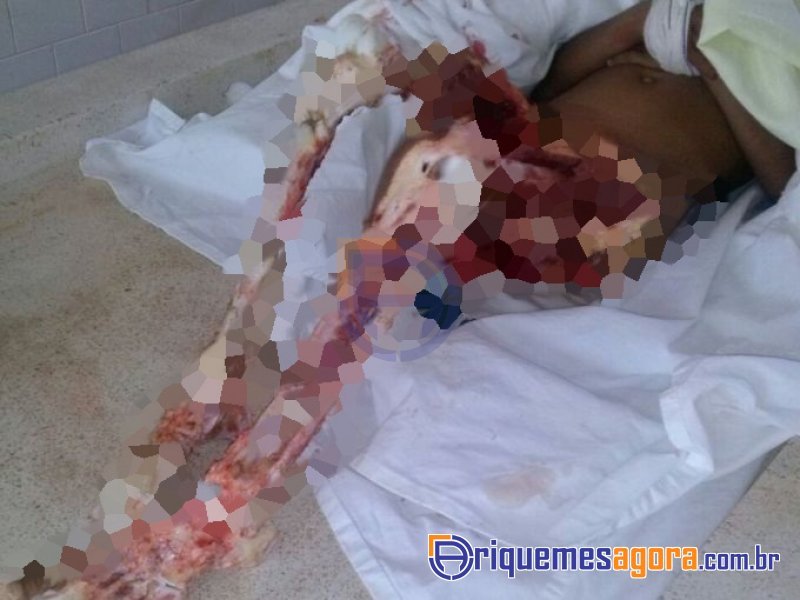 Φρίκη για 6χρονη στον Αμαζόνιο: Την κατασπάραξαν ζωντανή τα πιράνχας [εικόνες] | iefimerida.gr 1