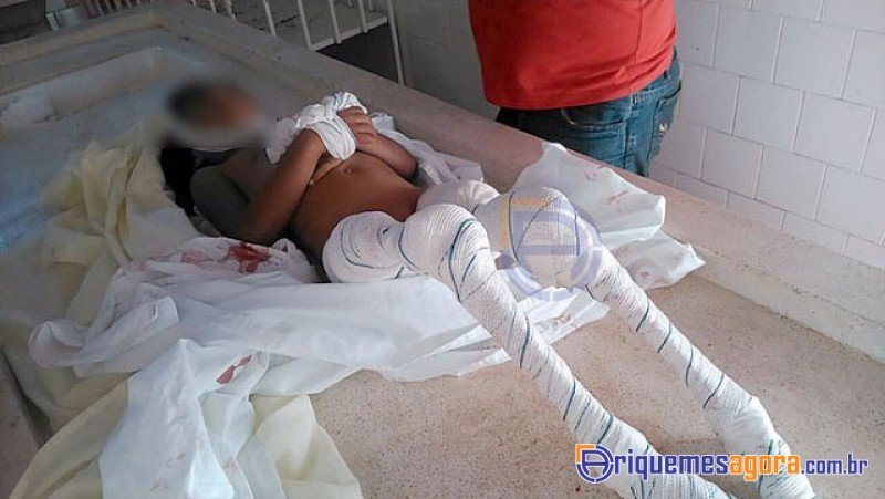 Φρίκη για 6χρονη στον Αμαζόνιο: Την κατασπάραξαν ζωντανή τα πιράνχας [εικόνες] | iefimerida.gr 0