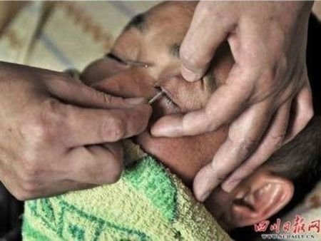 Καθαρισμός οφθαλμού: Μία αρχαία κινεζική τέχνη που αργοσβήνει [εικόνες] | iefimerida.gr 0