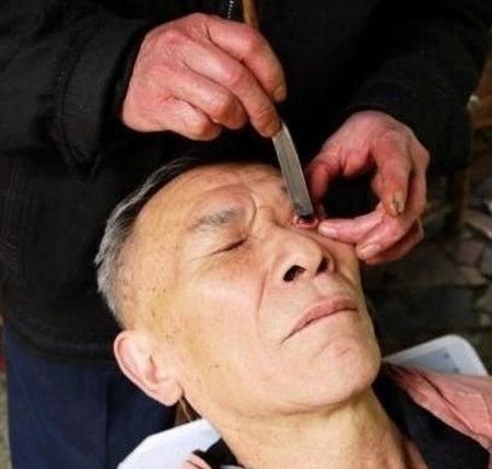 Καθαρισμός οφθαλμού: Μία αρχαία κινεζική τέχνη που αργοσβήνει [εικόνες] | iefimerida.gr 1