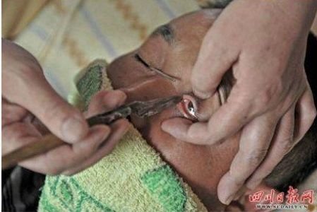 Καθαρισμός οφθαλμού: Μία αρχαία κινεζική τέχνη που αργοσβήνει [εικόνες] | iefimerida.gr 2