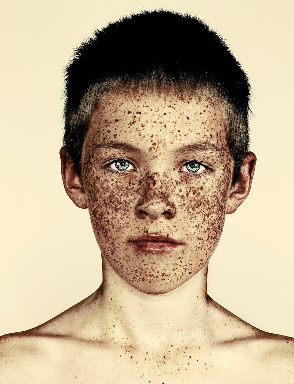 Η ομορφιά των φακίδων -Εντυπωσιακά πορτραίτα ανδρών και γυναικών [εικόνες] | iefimerida.gr 4