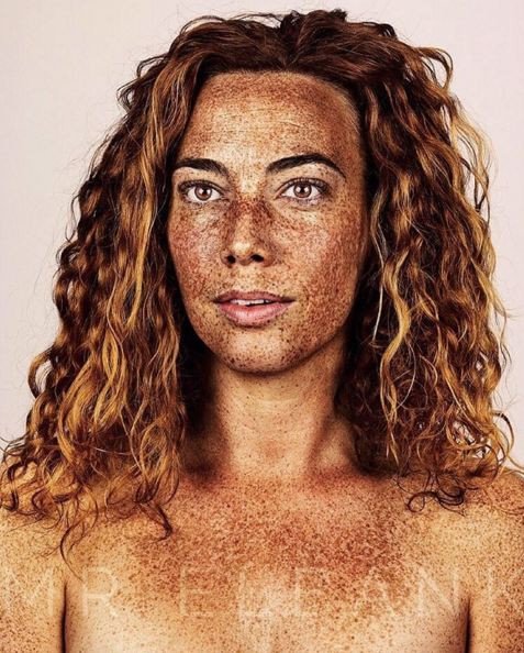 Η ομορφιά των φακίδων -Εντυπωσιακά πορτραίτα ανδρών και γυναικών [εικόνες] | iefimerida.gr 8