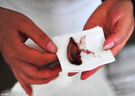 Αγέλη λύκων επιτέθηκε σε Κινέζους αγρότες -Προσπάθησαν να σώσουν τα πρόβατά τους και τραυματίστηκαν σοβαρά [εικόνες] | iefimerida.gr 1