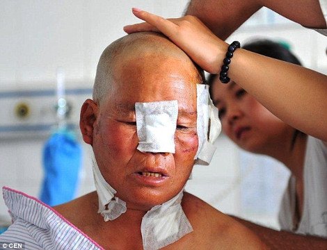 Αγέλη λύκων επιτέθηκε σε Κινέζους αγρότες -Προσπάθησαν να σώσουν τα πρόβατά τους και τραυματίστηκαν σοβαρά [εικόνες] | iefimerida.gr 3