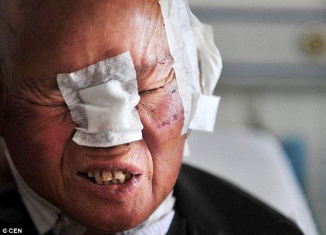 Αγέλη λύκων επιτέθηκε σε Κινέζους αγρότες -Προσπάθησαν να σώσουν τα πρόβατά τους και τραυματίστηκαν σοβαρά [εικόνες] | iefimerida.gr 4