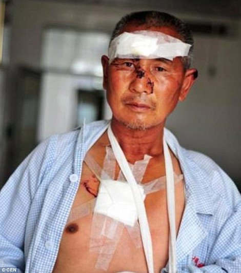 Αγέλη λύκων επιτέθηκε σε Κινέζους αγρότες -Προσπάθησαν να σώσουν τα πρόβατά τους και τραυματίστηκαν σοβαρά [εικόνες] | iefimerida.gr 5