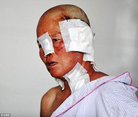 Αγέλη λύκων επιτέθηκε σε Κινέζους αγρότες -Προσπάθησαν να σώσουν τα πρόβατά τους και τραυματίστηκαν σοβαρά [εικόνες] | iefimerida.gr 0