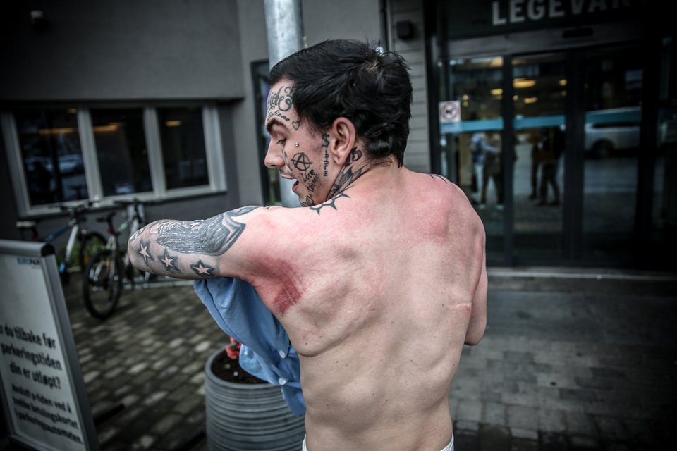 Απίστευτο: Σφήνωσε σε λεκάνη τουαλέτας προσπαθώντας να σώσει το κινητό φίλου του [εικόνες] | iefimerida.gr 0