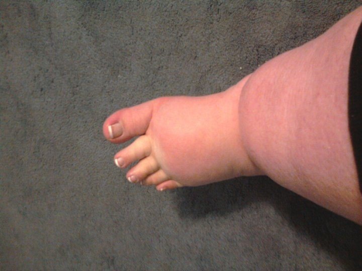 Λύγισαν τα τακούνια της Κιμ Καρντάσιαν από το... πάχος [εικόνες] | iefimerida.gr 6