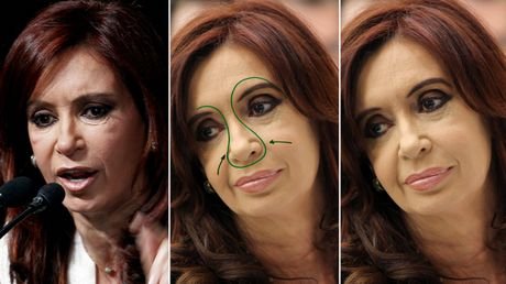 Πολιτικοί που είπαν «ναι» στις πλαστικές και στο μπότοξ [εικόνες] | iefimerida.gr 4