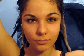 Εκανε 100 ενέσεις σιλικόνης στα χείλη για να μοιάσει στην Τζέσικα Ράμπιτ [εικόνες] | iefimerida.gr 0