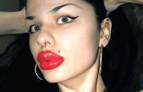 Εκανε 100 ενέσεις σιλικόνης στα χείλη για να μοιάσει στην Τζέσικα Ράμπιτ [εικόνες] | iefimerida.gr 1