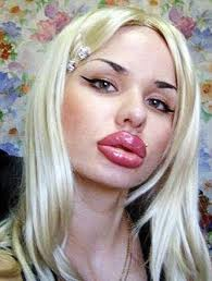 Εκανε 100 ενέσεις σιλικόνης στα χείλη για να μοιάσει στην Τζέσικα Ράμπιτ [εικόνες] | iefimerida.gr 2