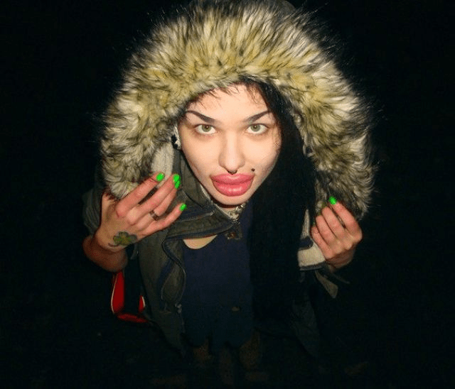 Εκανε 100 ενέσεις σιλικόνης στα χείλη για να μοιάσει στην Τζέσικα Ράμπιτ [εικόνες] | iefimerida.gr 3