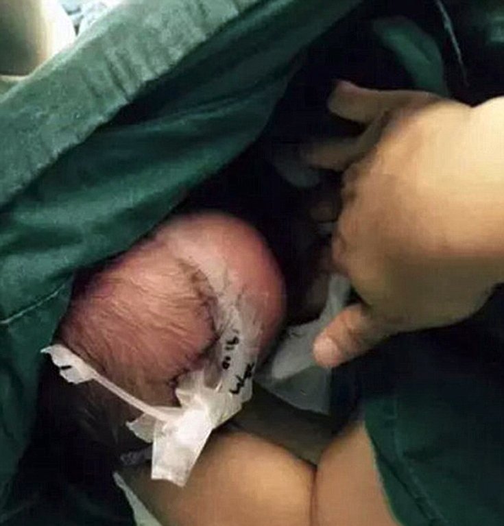 Νοσοκόμα–«άγγελος»: Θήλασε βρέφος την ώρα που του έκαναν επέμβαση [εικόνες]  | iefimerida.gr 1