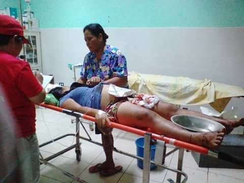 Εκρηξη σε ξενοδοχείο στις Φιλιππίνες -Πολλοί τραυματίες, πληροφορίες για νεκρούς [εικόνες] | iefimerida.gr 0