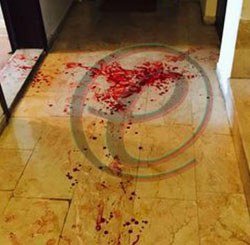 Χαροπαλεύει πολιτικός του φιλοκουρδικού κόμματος: Τον μαχαίρωσαν μέρα μεσημέρι [βίντεο & εικόνες] | iefimerida.gr 1