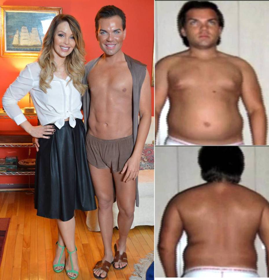 Εθισμένος στις πλαστικές: Εχει ξοδέψει 164.047 ευρώ σε 24 επεμβάσεις για να κάνει το «τέλειο σώμα» [εικόνες] | iefimerida.gr 3