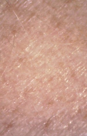 Νεαρή έτρωγε μια εβδομάδα μόνο junk food -Πώς έγινε [εικόνες] | iefimerida.gr 10