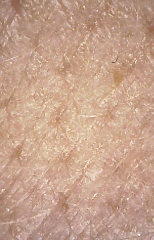 Νεαρή έτρωγε μια εβδομάδα μόνο junk food -Πώς έγινε [εικόνες] | iefimerida.gr 11