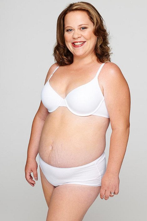 Πέντε γυναίκες που έγιναν πρόσφατα μαμάδες δείχνουν το σώμα τους όπως πραγματικά είναι: Με παραπανίσια κιλά, ραγάδες και χαλάρωση [εικόνες] | iefimerida.gr 0