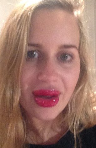 Φούσκωσε τα χείλη της με συσκευή βεντούζα για να μοιάσει στην Καρντάσιαν [εικόνες] | iefimerida.gr 0