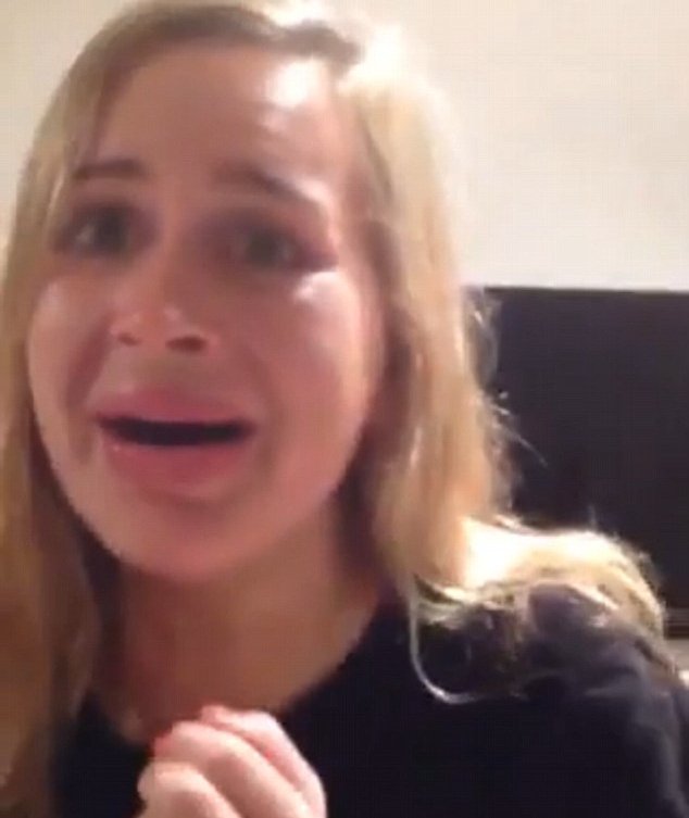 Φούσκωσε τα χείλη της με συσκευή βεντούζα για να μοιάσει στην Καρντάσιαν [εικόνες] | iefimerida.gr 3