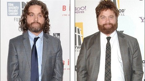 Αγνώριστος ο Ζακ Γαλιφιανάκης -Εμεινε μισός [εικόνες] | iefimerida.gr 0