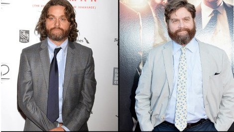 Αγνώριστος ο Ζακ Γαλιφιανάκης -Εμεινε μισός [εικόνες] | iefimerida.gr 1