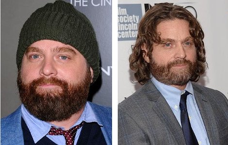 Αγνώριστος ο Ζακ Γαλιφιανάκης -Εμεινε μισός [εικόνες] | iefimerida.gr 2