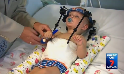 Ενα χειρουργικό θαύμα - 16 μηνών αγόρι υπέστη εσωτερικό αποκεφαλισμό και τα κατάφερε [εικόνες] | iefimerida.gr 2