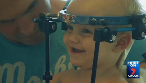 Ενα χειρουργικό θαύμα - 16 μηνών αγόρι υπέστη εσωτερικό αποκεφαλισμό και τα κατάφερε [εικόνες] | iefimerida.gr 1