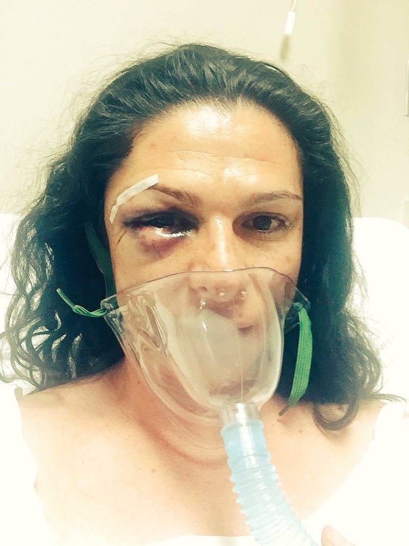 Θύμα άγριου ξυλοδαρμού Ολυμπιονίκης στο Μεξικό -Την έστειλαν στο νοσοκομείο [εικόνα] | iefimerida.gr 0