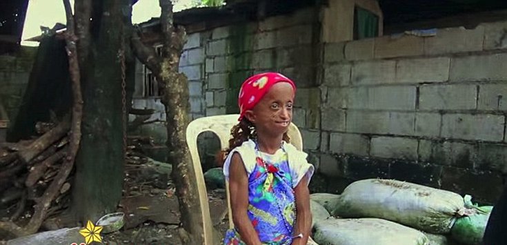 Η γηραιότερη γυναίκα της Ασίας είναι... 18 ετών – Η απίστευτη ιστορία ενός κοριτσιού από τις Φιλιππίνες [εικόνες] | iefimerida.gr 4