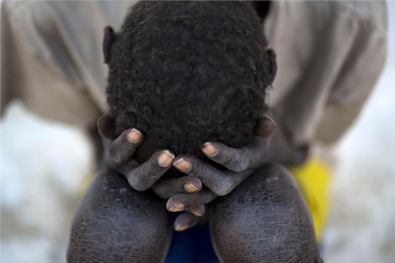 Οι Γιατροί Χωρίς Σύνορα αποχαιρετούν το 2015 με 10 φωτογραφικά στιγμιότυπα που τους σημάδεψαν [εικόνες] | iefimerida.gr 11