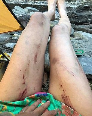 Πέθανε από το κρύο: Τραγικό τέλος για την γνωστή Ταϊβανέζα που πόζαρε με μπικίνι σε βουνοκορφές [εικόνες] | iefimerida.gr 4