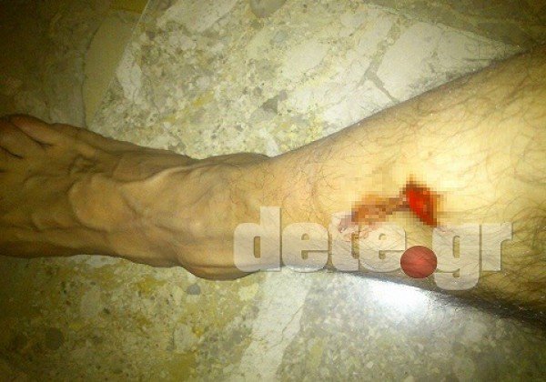 Γαμήλιο γλέντι βάφτηκε με αίμα στην Αχαΐα -Καλεσμένος έπεσε τραυματισμένος μπροστά στο ζευγάρι [εικόνες] | iefimerida.gr 0