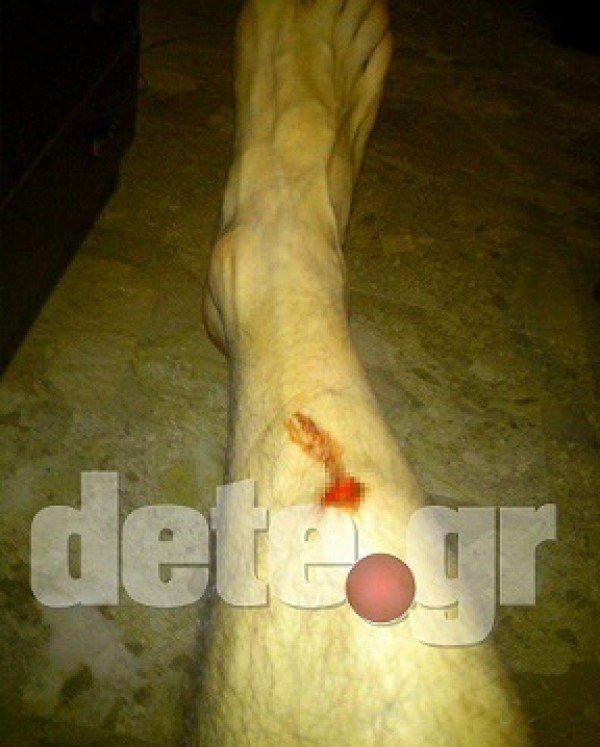 Γαμήλιο γλέντι βάφτηκε με αίμα στην Αχαΐα -Καλεσμένος έπεσε τραυματισμένος μπροστά στο ζευγάρι [εικόνες] | iefimerida.gr 1